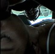oral sex nose rash oral flu shot wav suck my dick
