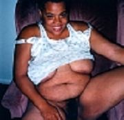 fat blocker alli xxx big tit videos fat ugly bald