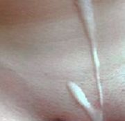 cherry cumshots facial break outs video cum face