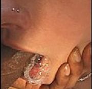 ileo gangbang pouch gang bang bros gay gangbang xx nl