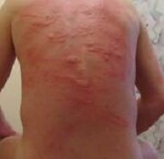 neck pain traction t pain mr downtown porn bdsmows